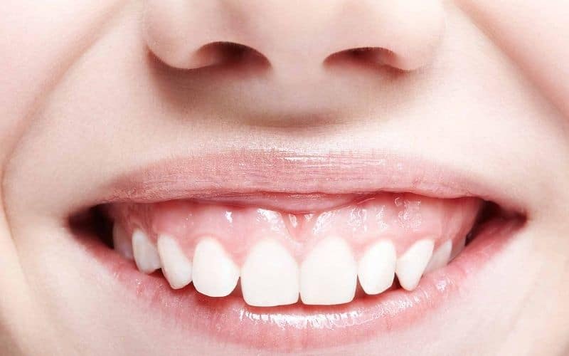 <trp-post-container data-trp-post-id='920'>Causes of a gummy smile and ways to treat it</trp-post-container>