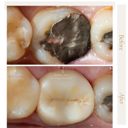 Before and After Instagram Post (2)