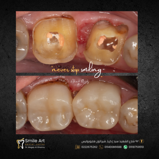 Smile Art Cases (6)