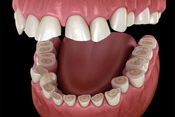 teeth-grinding-treatment-libertyville-il